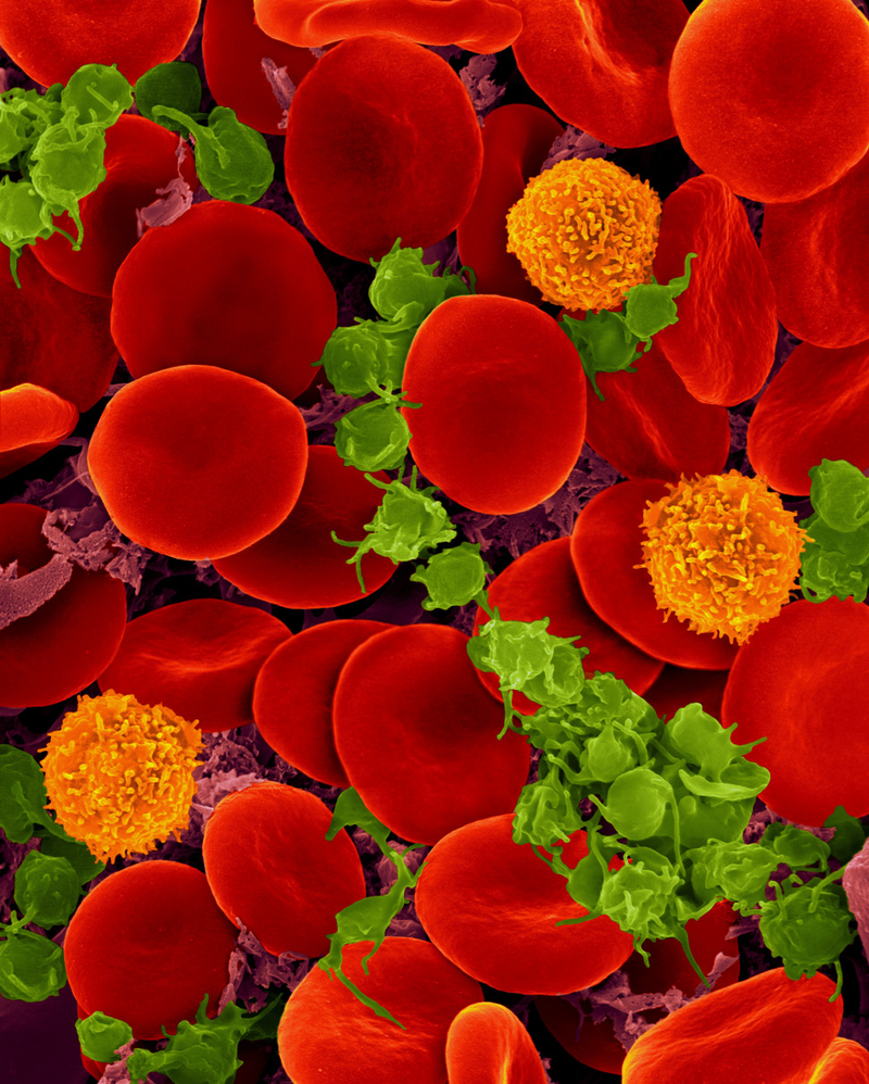 Illustration for article titled The Astounding And Horrific World As Seen Under A Microscope